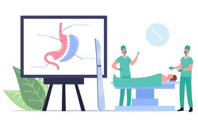 JUIN : Chirurgie Bariatrique